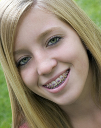 smiling girl with braces brushing her teeth